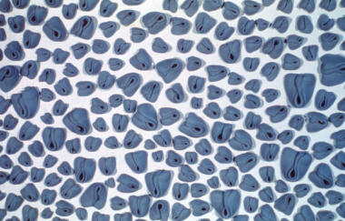 Wilke Untitled 1974 From Needed Erase Her Series A Detail 1